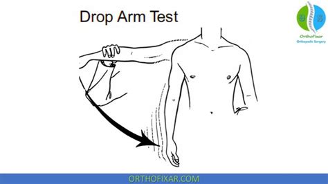 arm drop test|drop arm test shoulder positive.